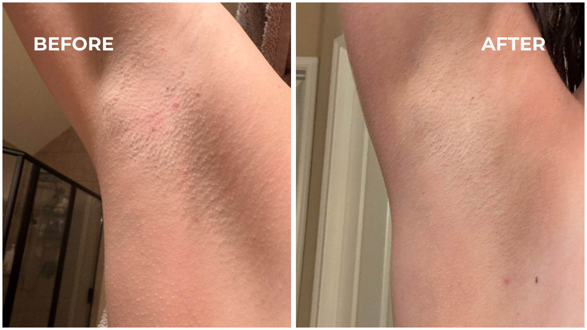 Bikini Oil